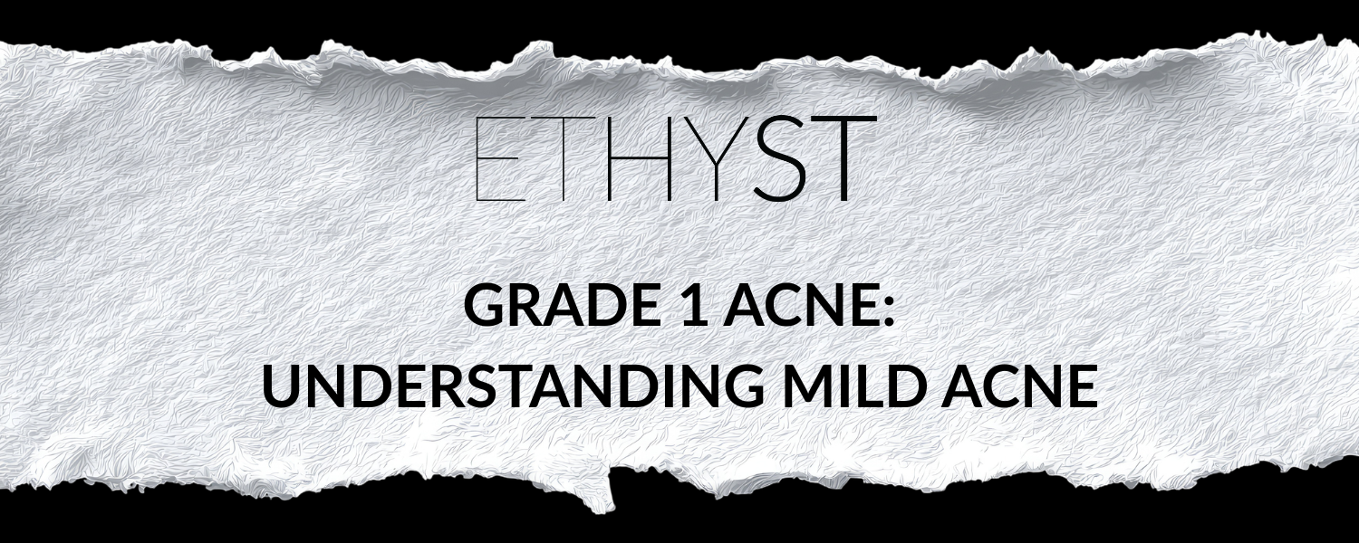 Grade 1 Acne: Understanding Mild Acne
