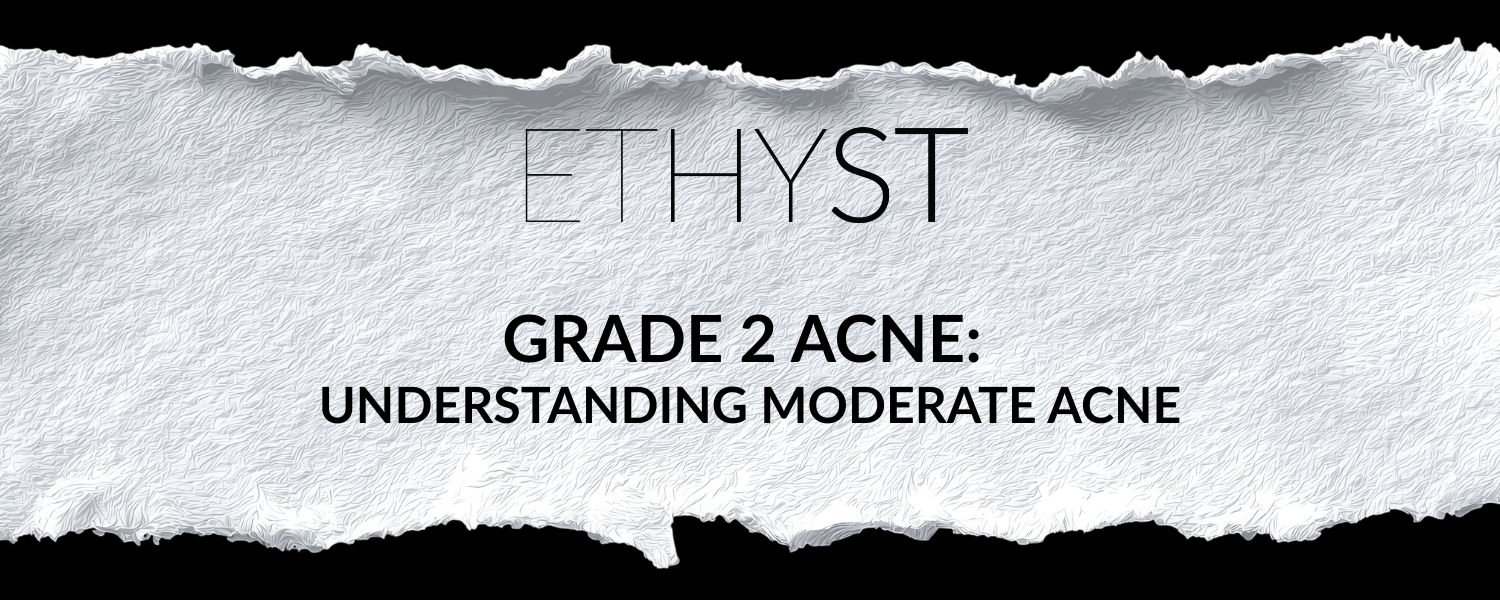 Grade 2 Acne: Understanding Moderate Acne