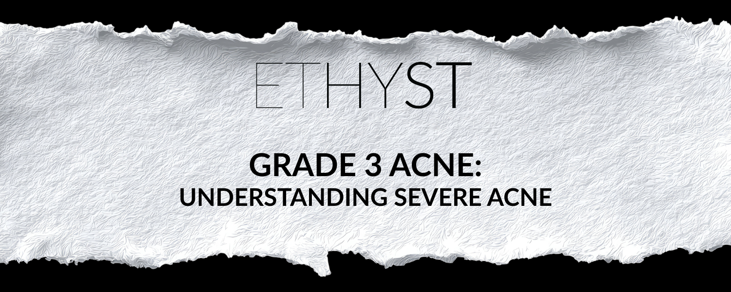 Grade 3 Acne: Understanding Severe Acne