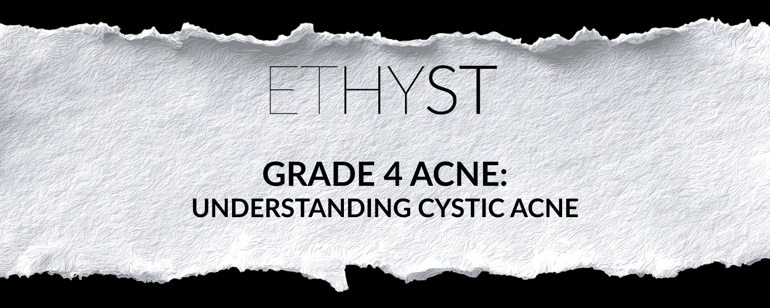 Grade 4 Acne: Understanding Cystic Acne