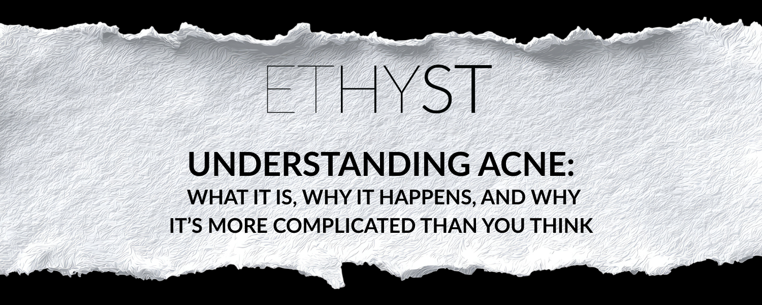 Understanding Acne: What It Is, Why It Happens, and Why It’s More Complicated Than You Think