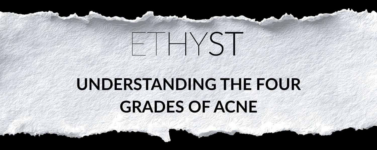 Understanding the Four Grades of Acne